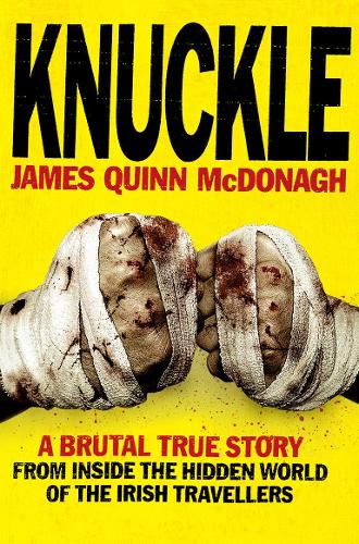 Knuckle