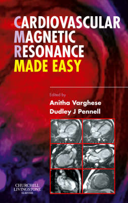 Cardiovascular Magnetic Resonance Made Easy