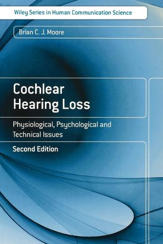 Cochlear Hearing Loss