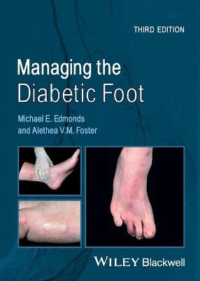 Managing the Diabetic Foot