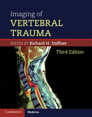 Imaging of Vertebral Trauma