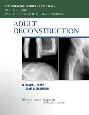 Adult Reconstruction