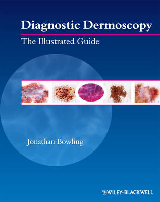 Diagnostic Dermoscopy – The Illustrated Guide