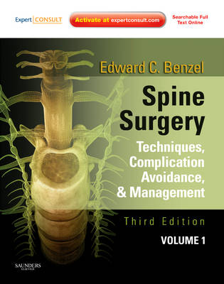 Spine Surgery