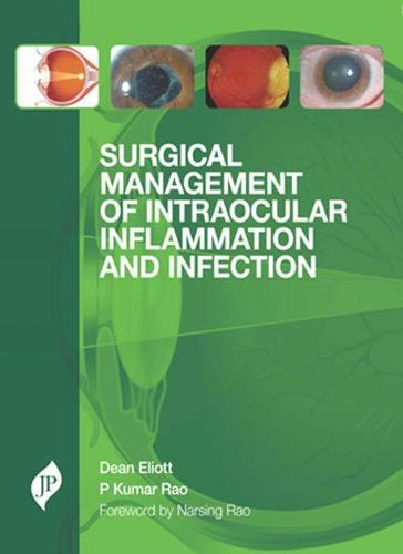 Surgical Management of Intraocular Inflammation and Infection