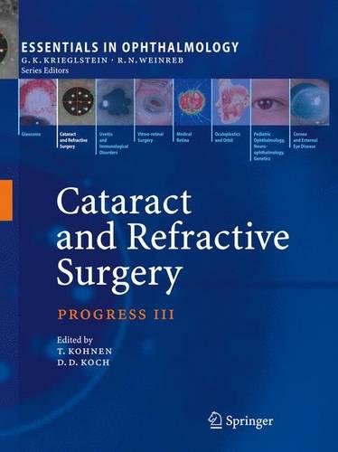 Cataract and Refractive Surgery