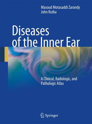 Diseases of the Inner Ear