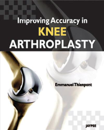 Improving Accuracy in Knee Arthroplasty