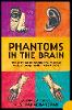 Phantoms in the Brain